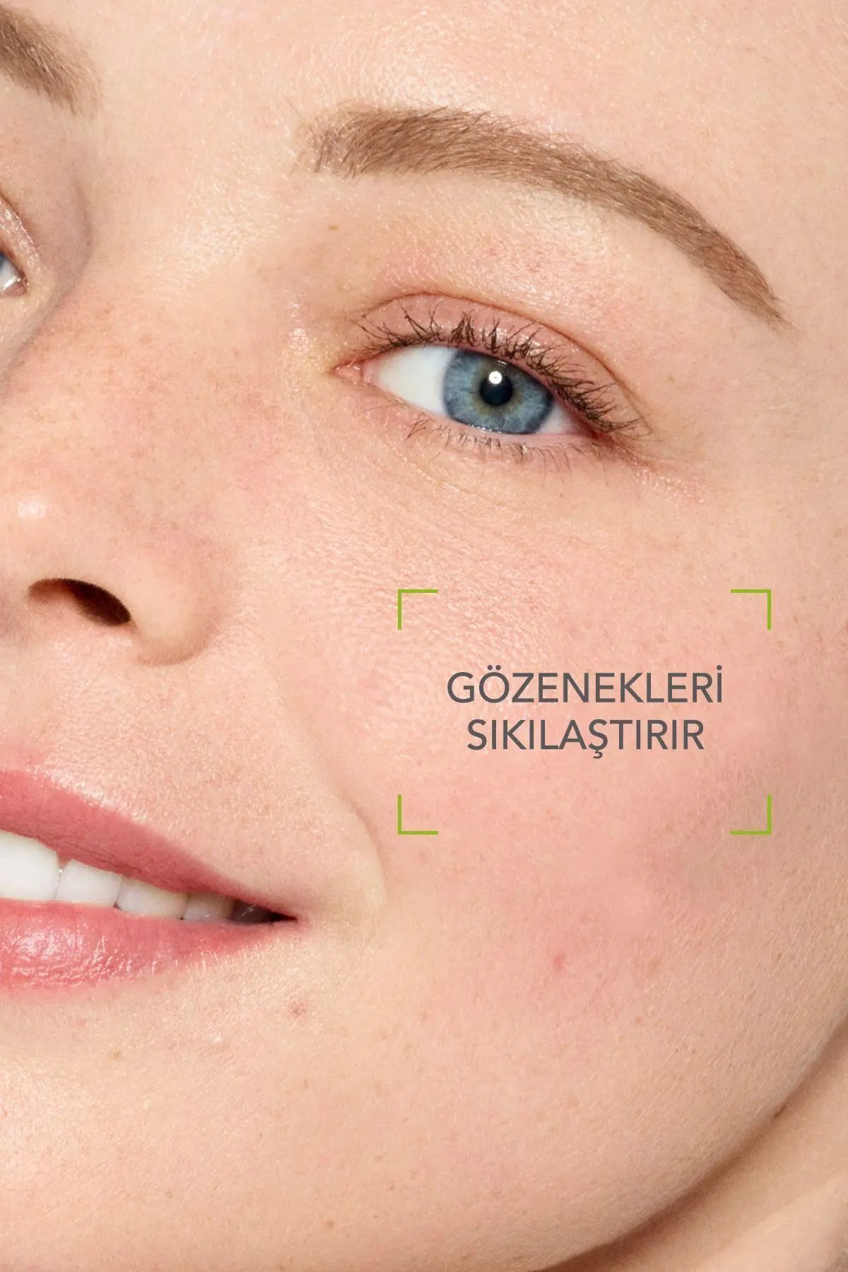 Sebium Lotion Gözenek Sıkılaştırıcı, Siyah Nokta Karşıtı Arındırıcı Salisilik Asit Tonik 200 ml