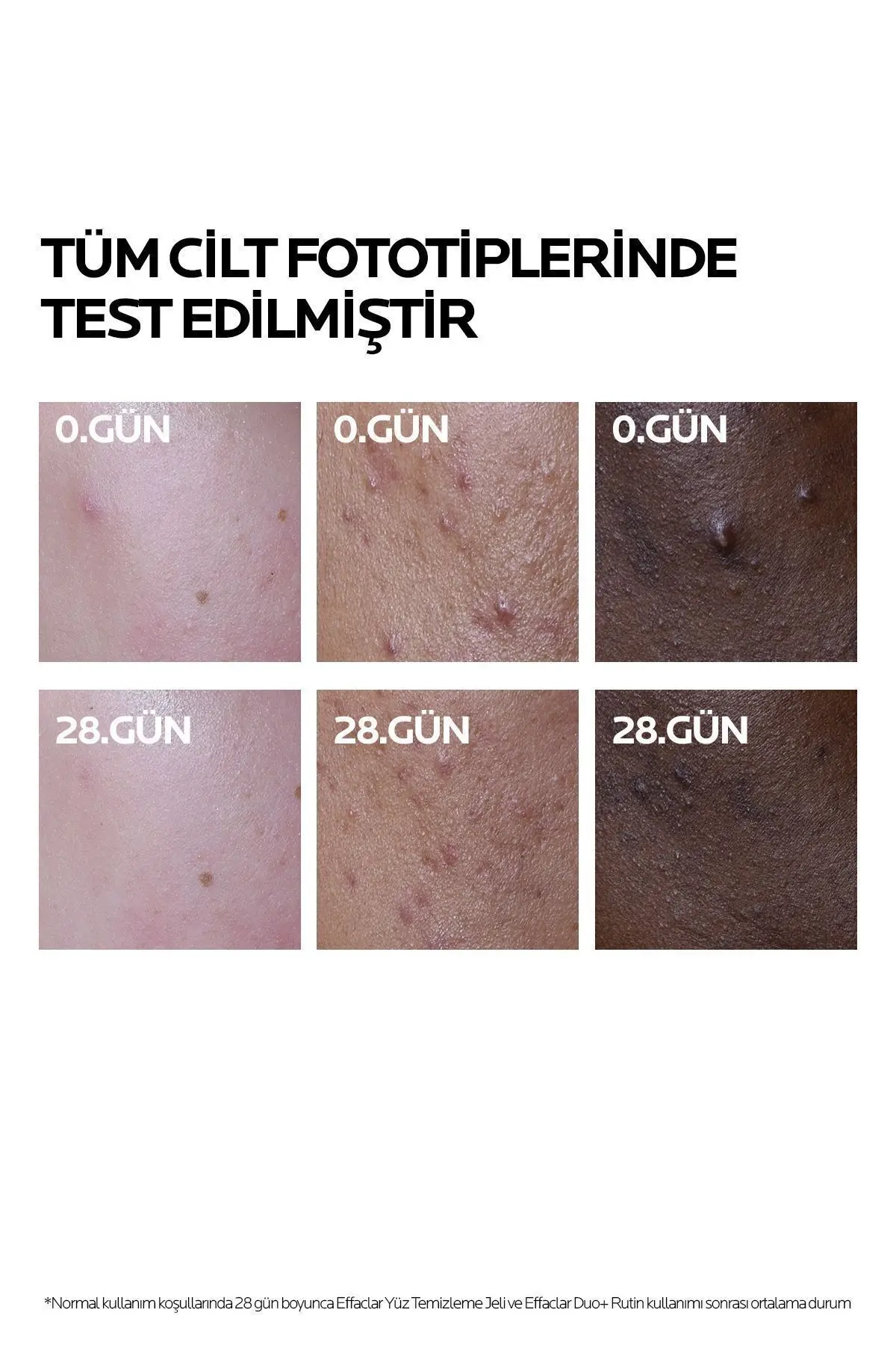 Effaclar Duo+M Yağlı Ve Akneye Eğilimli Ciltler için Yüz Bakım Kremi 40 ml
