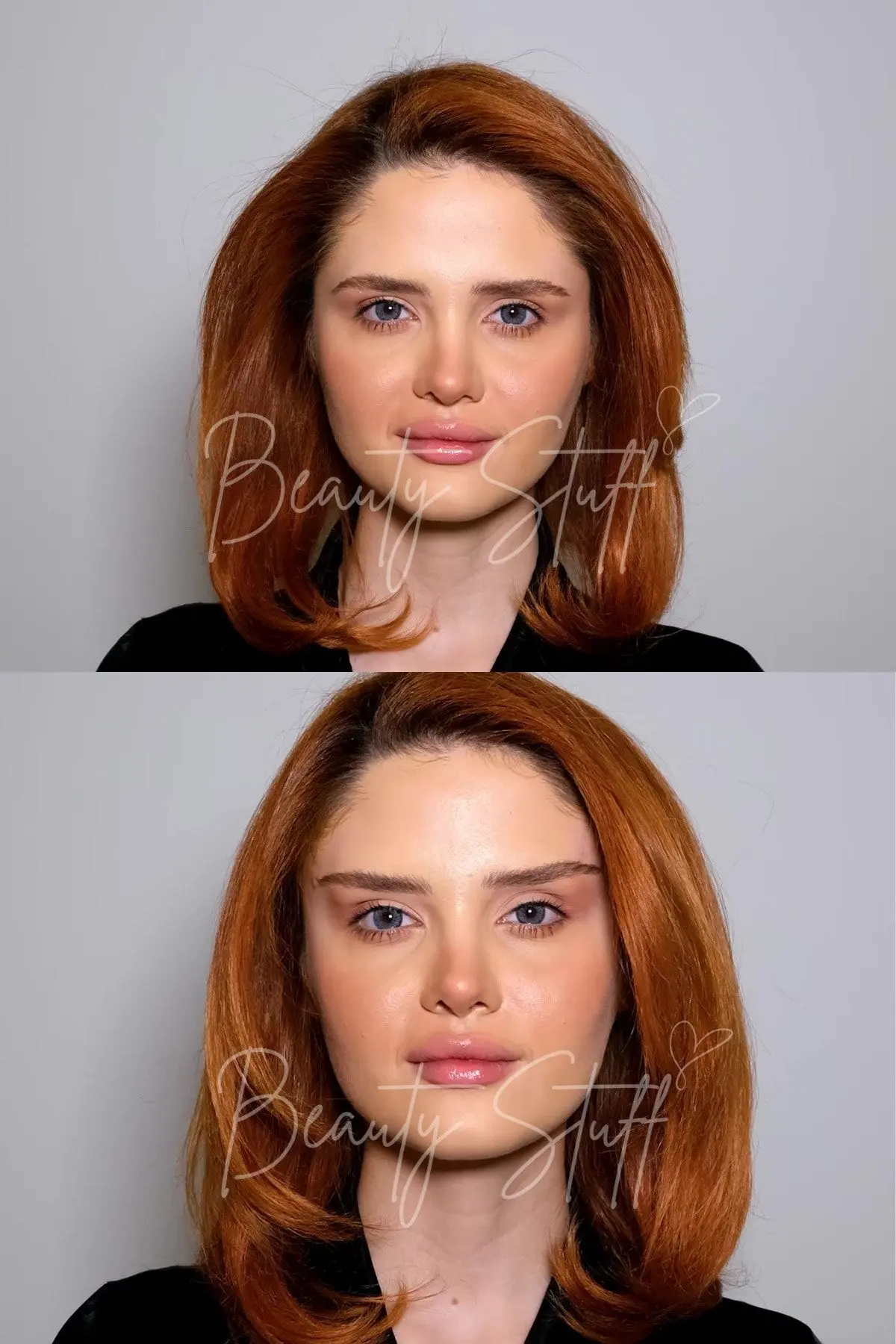 Kahverengi Lastikli Lift 'Em Up Yüz & Göz Germe Bantları (20'li paket) (Made in USA)