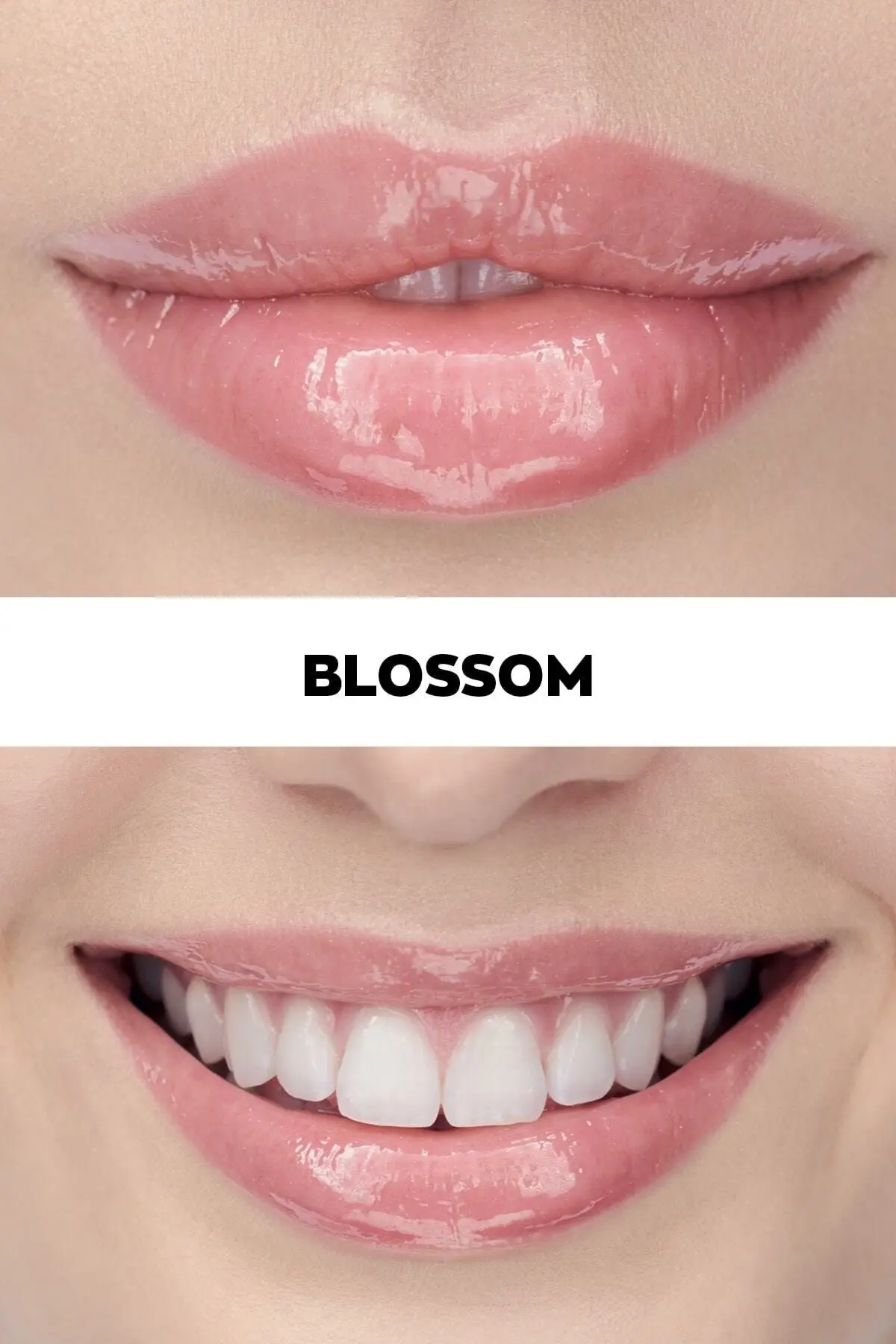 True Dudak Bakım Yağı Blossom - 7ml