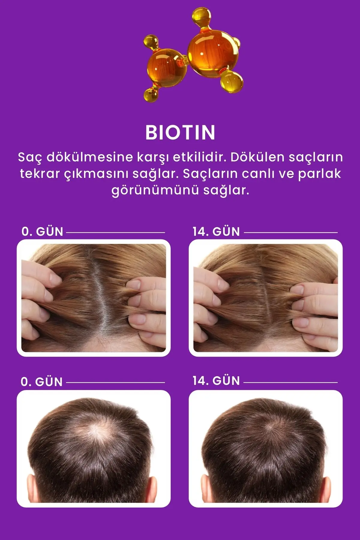 Kolajen Ve Keratin Saç Dökülmesine Karşı Hızlı Sac Uzatan Dolgunlaştırıcı Onarıcı Besleyici Şampuan